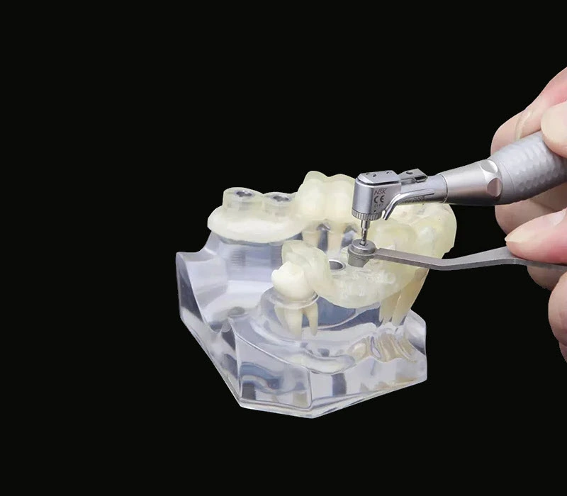 Dental Practice Solutions - Guided Implant Surgery & Diagnostics
