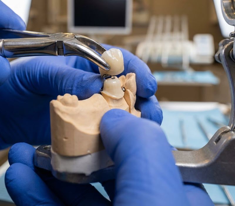 Dental Practice Solutions - Same-Day Restorations